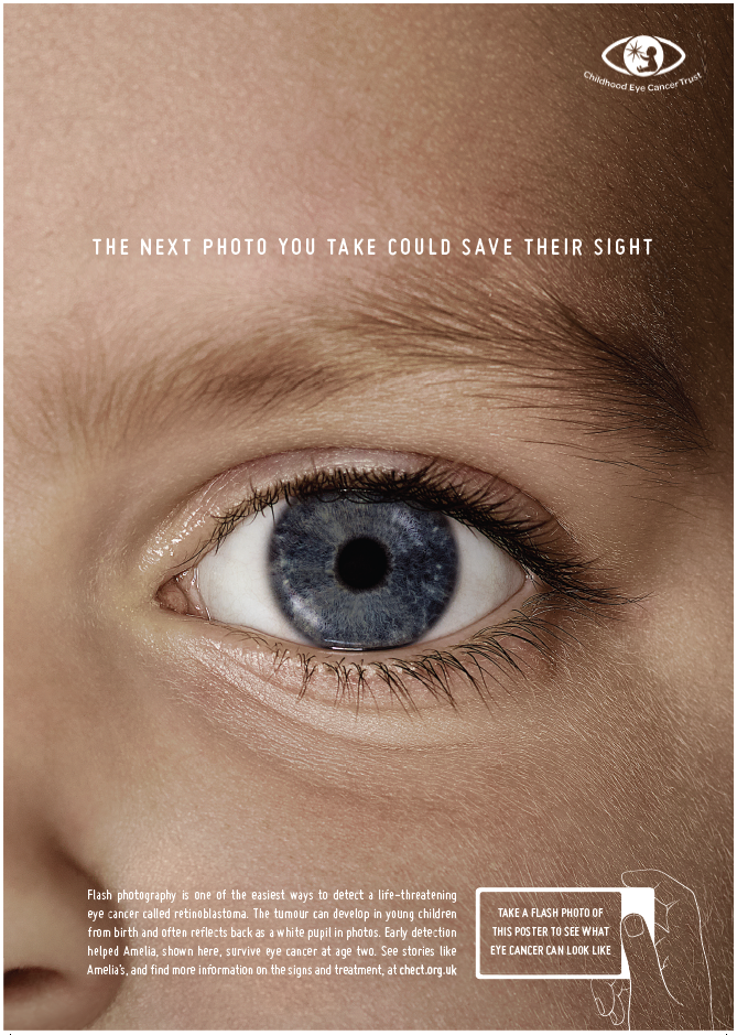 ChectUK's tweet photo. Childhood eye cancer can cause tumours in children as young as birth #haveyouCHECT http://t.co/4h1WTPHvk4 http://t.co/5CTgu6bItN