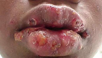 prideys's tweet image. rt or you will wake up having this tomorrow forever.