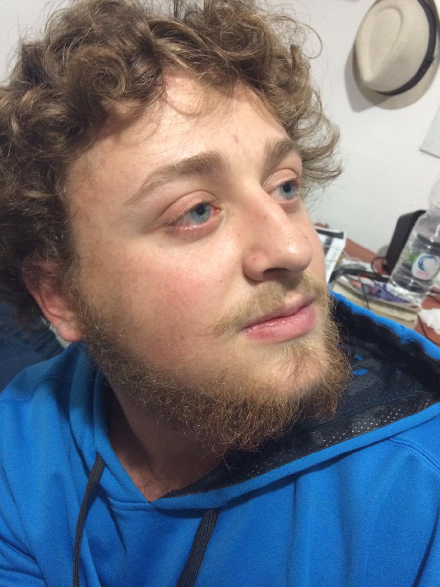 shaveforacause1's tweet photo. Before and after #ShavedForACause http://t.co/WzkO3VC9Gq