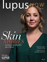 DCLion's tweet image. I'm on the cover of the fall issue of @LupusOrg's magazine. Subscribe! #fightlupus #lupusislame