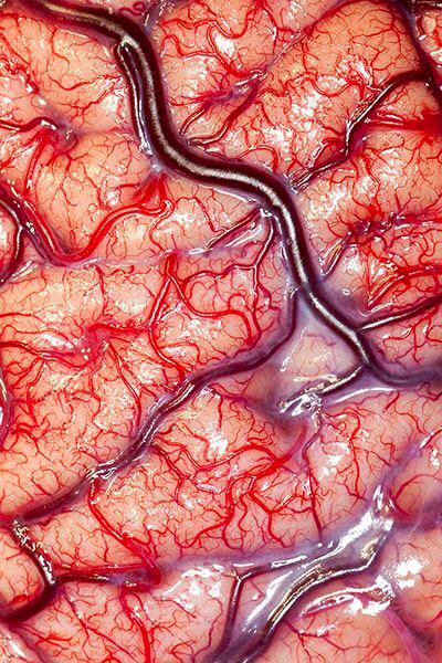 ScienceATM's tweet image. This is what the surface of the human brain looks like!