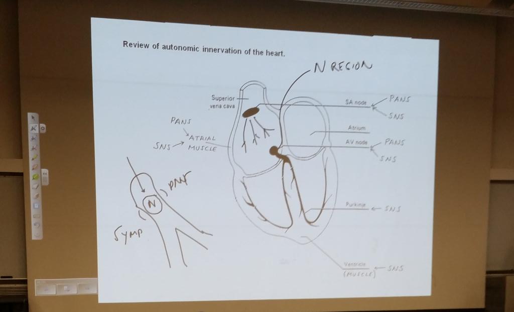 NYMCSenate's tweet photo. Live tweet in lecture - "the AV node is complicated, as all things are..." #MedSchool #LifesLessons http://t.co/WHelcHJckg