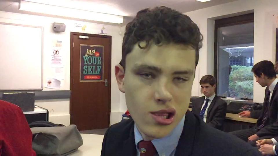 WoodburyGreg's tweet image. Genuinely no effects on these, just shaking his head from side to side #ApparentlyThisKidIsAModel #SelectModels