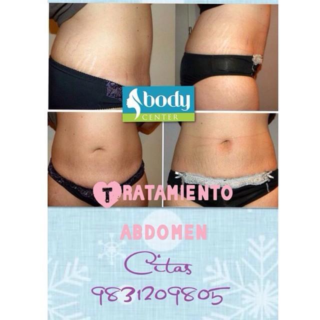 HumbertoCastr65's tweet photo. En la primera sesión pierde de 1 a 21 cms! Devuelvele a tu piel firmeza y elasticidad con nuestros productos! Eli... http://t.co/oCxLDlk16Q