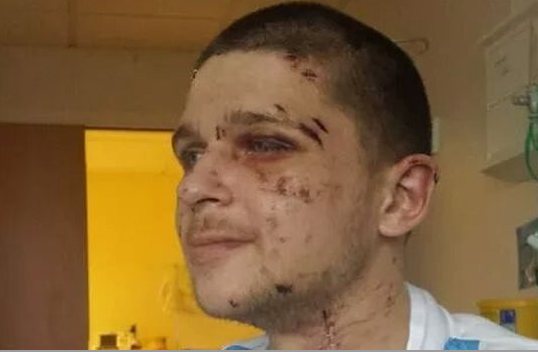 BBCNewsbeat's tweet image. One man speaks out about being the victim of domestic abuse bbc.in/1vuZx9Z