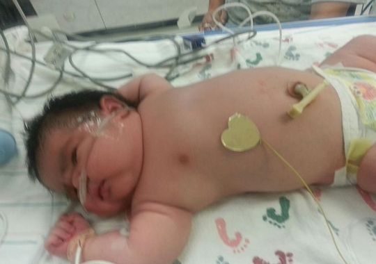 A3Noticias's tweet photo. Nace una bebé de 6,2 kilos en un hospital de Colorado http://t.co/y8WC3Rno39 http://t.co/ZmpIpVFZyF