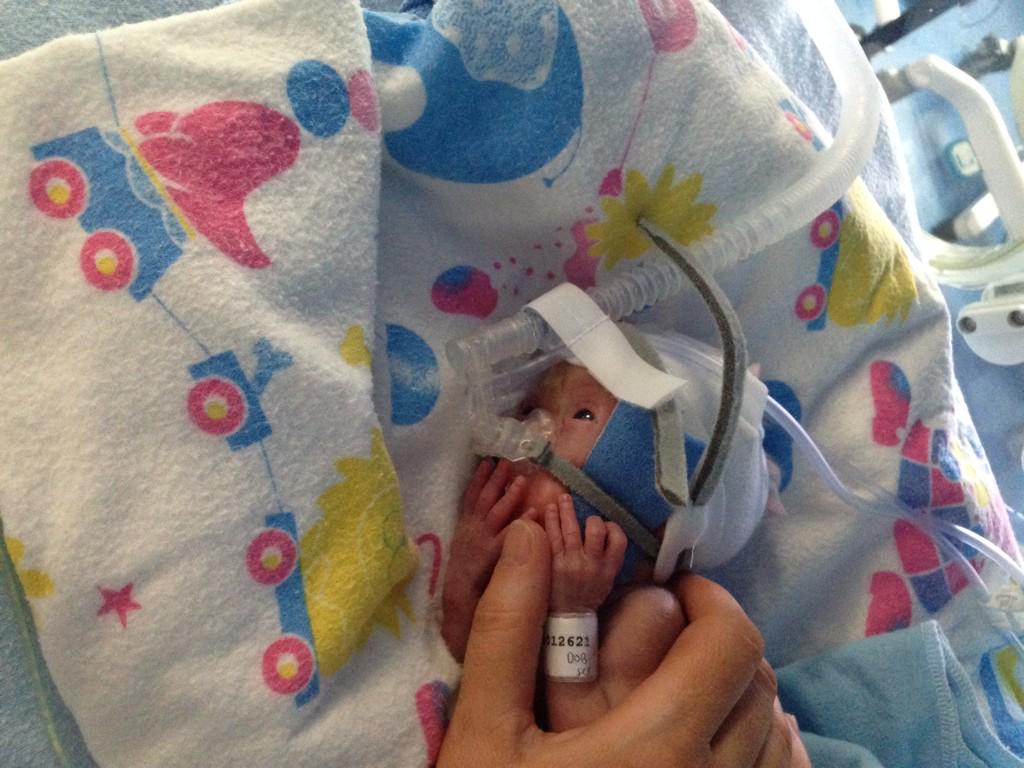 irefoy's tweet photo. The handsome little miracle odhràn getting bigger &amp; stronger every day 💞 come such a long way http://t.co/mRBexnsnoy