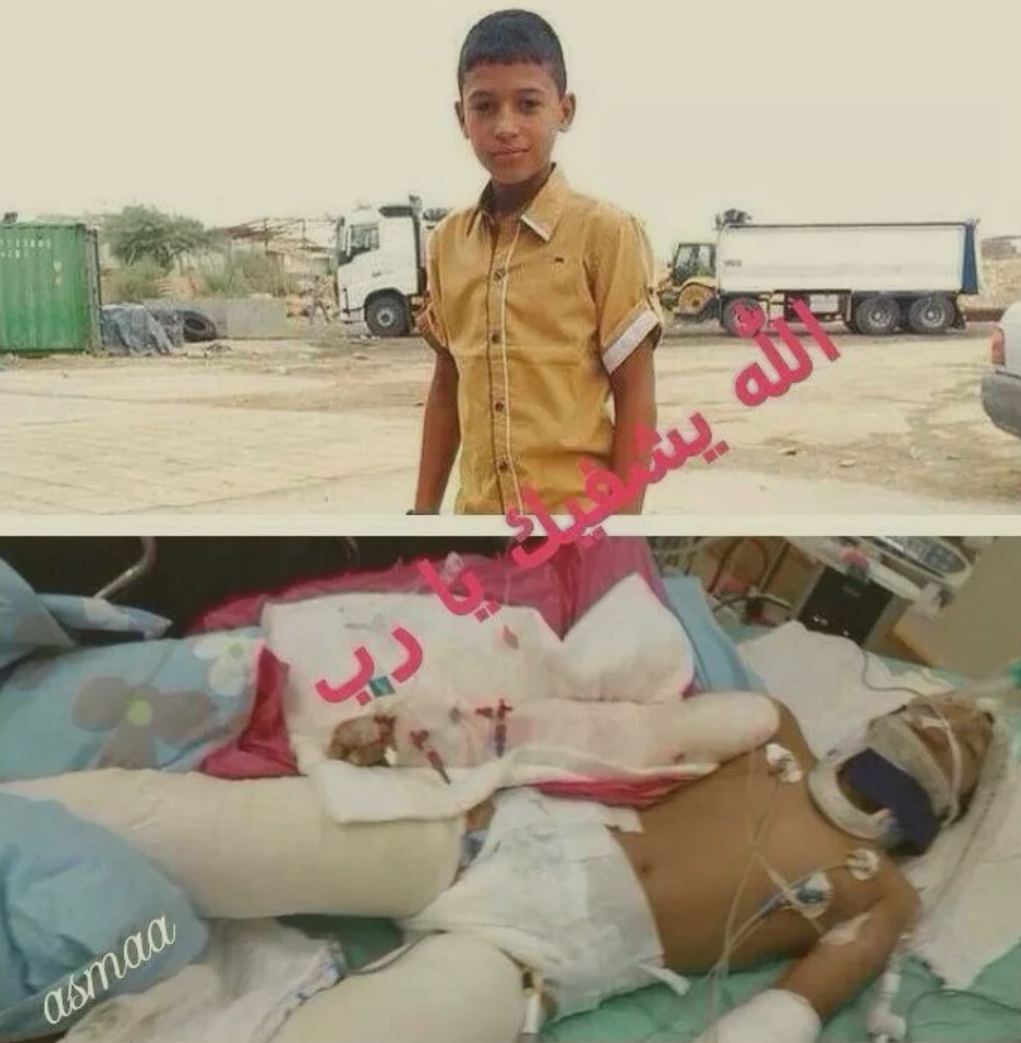tiitooo750's tweet photo. فتى عمود الكهرباء
في
الع��ايه المركزه http://t.co/uajZXq0paa