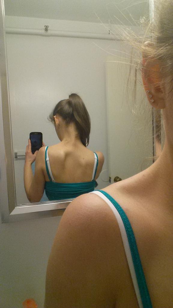 woahitsbecky's tweet photo. On top of a gimpy elbow, my scapula is the cause of my shoulder problem and chronic pain. #FlexibilityProblems http://t.co/hoydBqJMpl