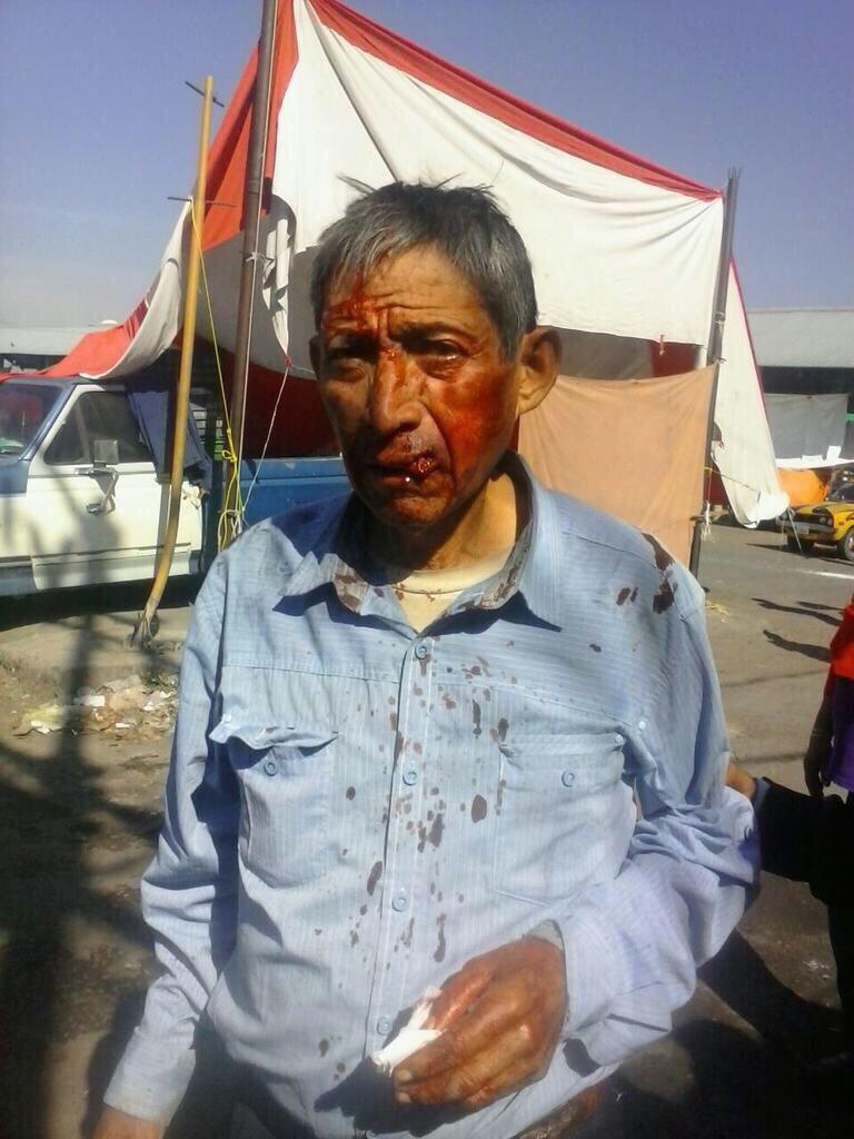 AaroonAron's tweet photo. @CiprianoCharrez El próximo Abarca de Hidalgo #CiprianoCulpable #JusticiaParaQuintín http://t.co/ditt81OpB1