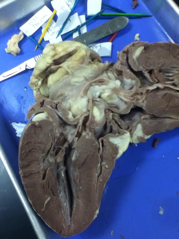 tiffiny226's tweet photo. heart disection #rhsbms http://t.co/pDTpzXqqPT