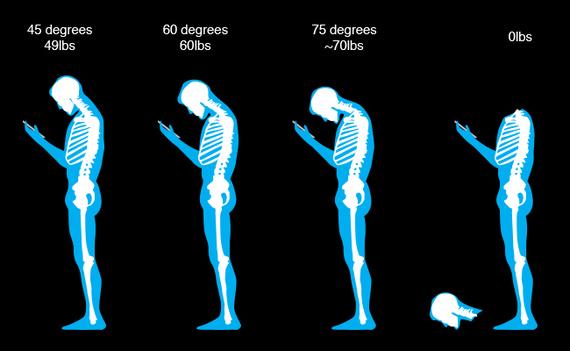 WebMD's tweet image. If You Keep Texting, Your Head Will Fall Off (a counter to recent #TextNeck news) @TheAtlantic wb.md/1CZnQly