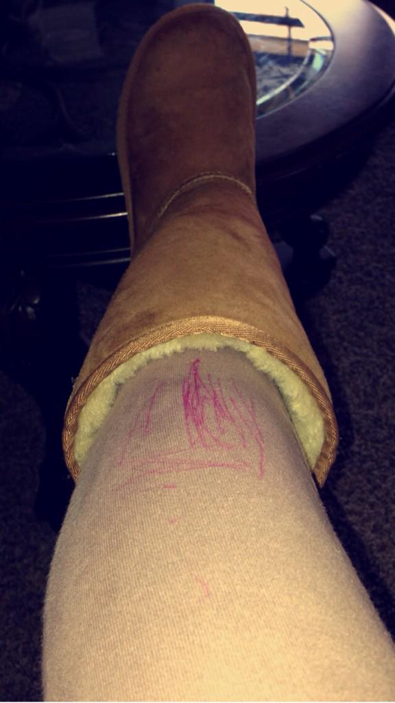 malpalhal's tweet photo. You know it's a rough little day when you scratch your leg with your pen forgetting it's open. #2ratchet http://t.co/zkzuaoSt8t