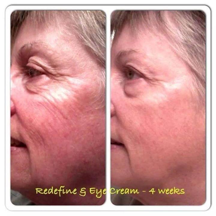 EllenJackson77's tweet photo. A picture is worth a thousand words, thank you RF for helping so many people feel great!! http://t.co/jf0GyZOEQ9