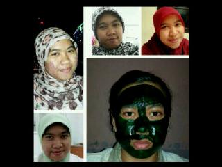 klinikMASKERku's tweet photo. Khasiat masker spirulina kami emg ampuh tuh,ngpain msih ragu Klo Udh bnyak bukti. Pin 29D1124C / call  08981439846 http://t.co/IZNDQkJ6FS