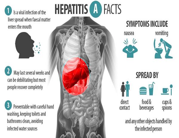 Hepatitis a symptoms