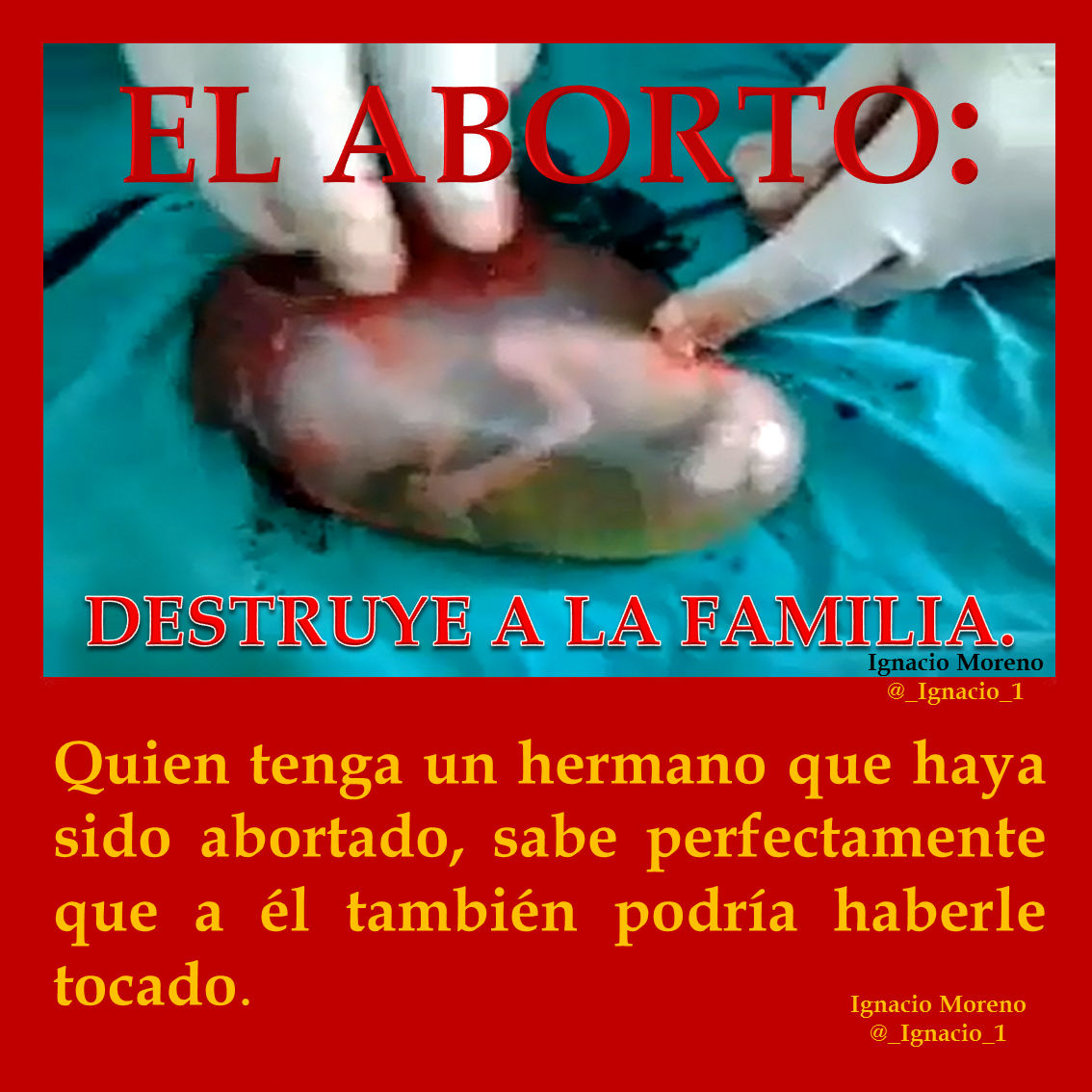 _Ignacio_1's tweet photo. #ABORTO: #Aborto0 #VidaSí.
#CongresoNacionalDeLaFamilia
#TransatlanticSummit2014
#PraytoEndAbortion
#Pray2EndAbortion http://t.co/Gp8R1CiK2H