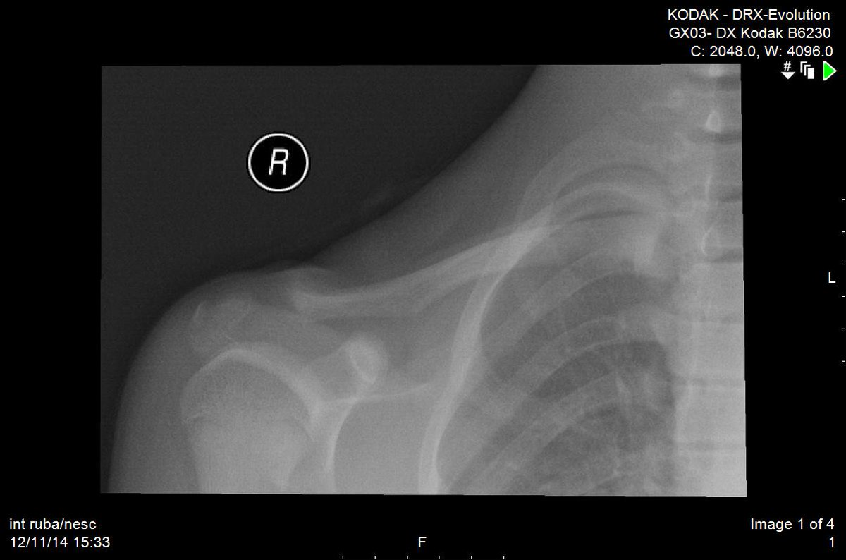 Rad_Bits's tweet photo. quiz number 73: no history...what is the differential diagnosis #radiology #meded #RSNA14 #FOAMed #radbits http://t.co/cQ5Xr1scdu