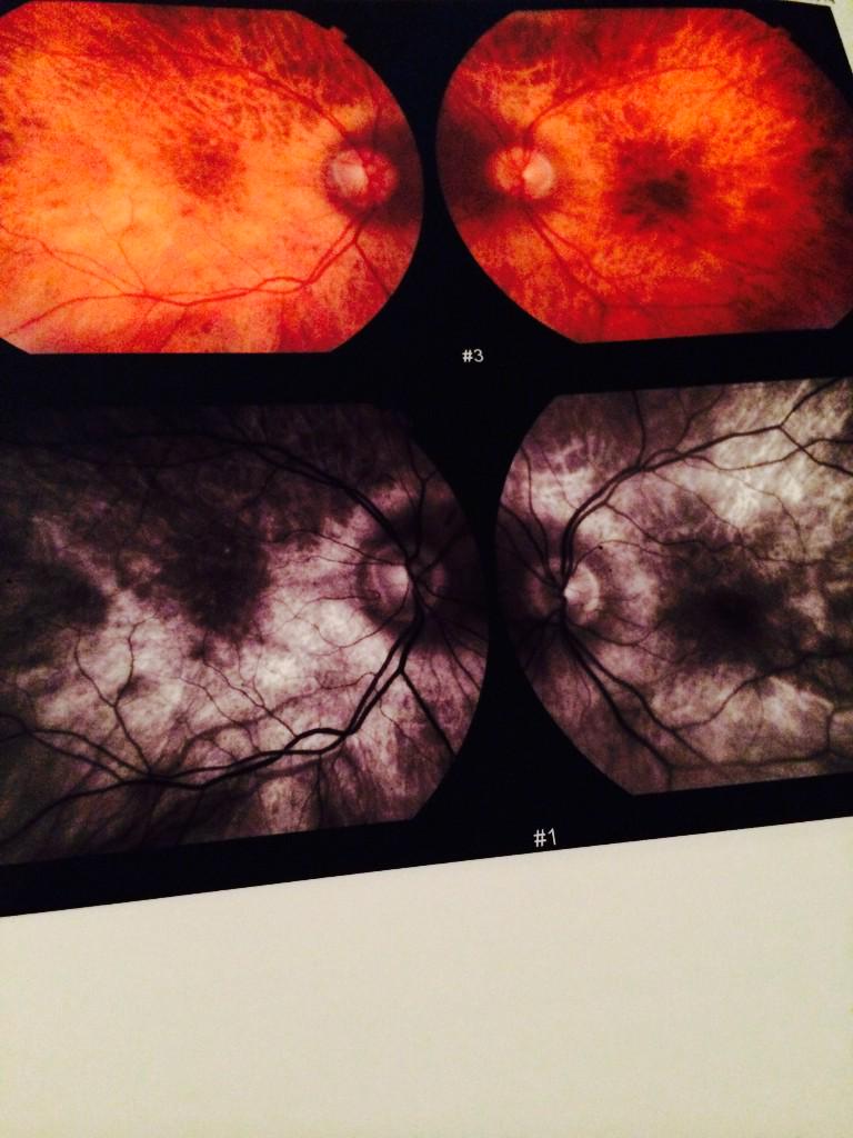 J_Osborne21's tweet photo. This is what I do for a living. #BackOfTheEye http://t.co/VBDI2d5VKM