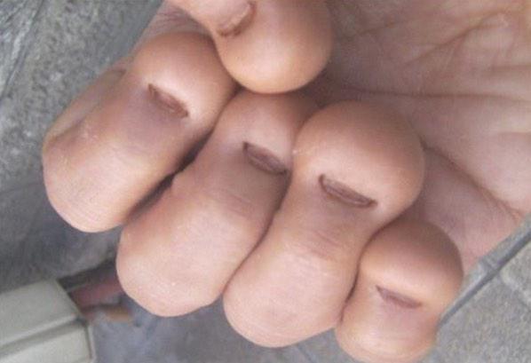 Why do people bite their nails?