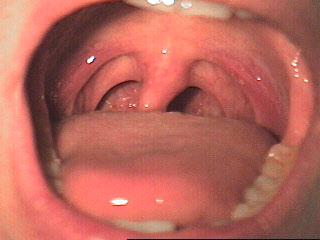 The Uvula (often mistaken as tonsils) helps seal the oral cavity from the nasal cavity while swallowing