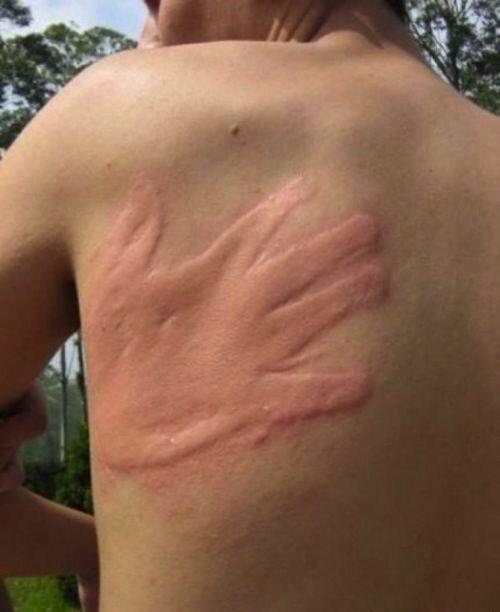 MisterNo_'s tweet photo. - Tenes un mosquito, no te muevas, ahí te lo saco. http://t.co/IxqiM8gIJ0
