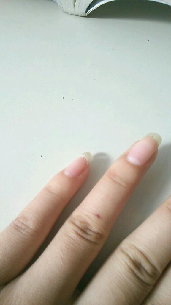 a_____xxx____a's tweet photo. 爪を剥ぎました（） http://t.co/EQIp0MWW3R