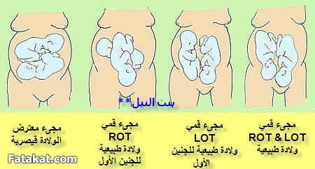 G_7awamel's tweet photo. http://t.co/kkP5akOV9v
