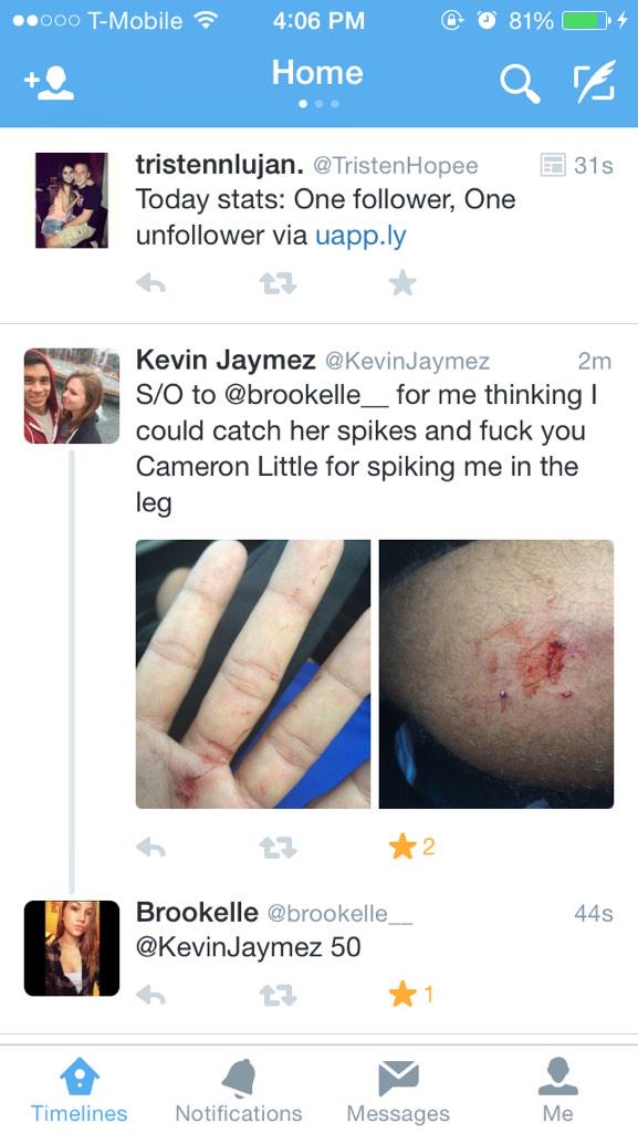 Conehead_Bois's tweet photo. @KevinJaymez @brookelle__ @MuleCoach 50 http://t.co/Rbvz4vLBvo