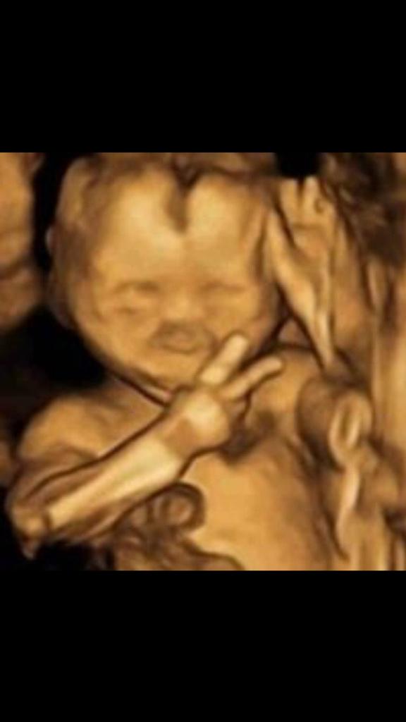Tonyred78's tweet image. Them 3d baby scans show just how much my son is like me! Can't believe the resemblence! #3dbabyscan #babyscan