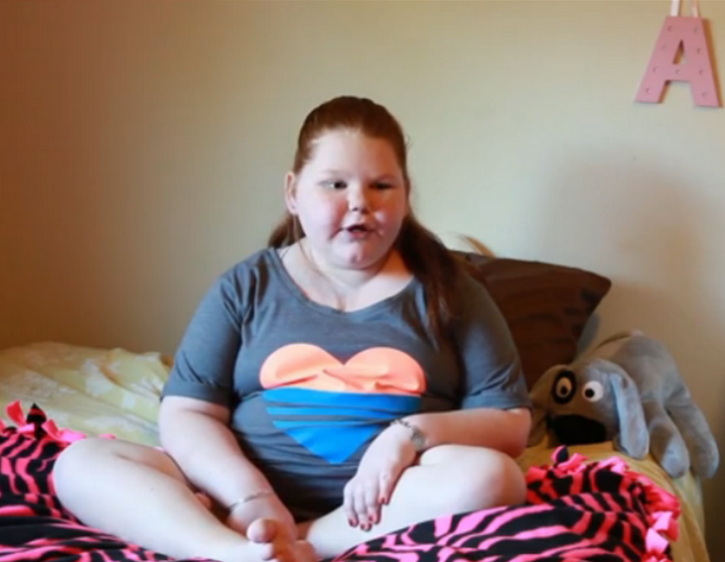 13 Year Old Girl With Rare Uncontrollable Weight Gain Loses 60 Pounds After Surgery