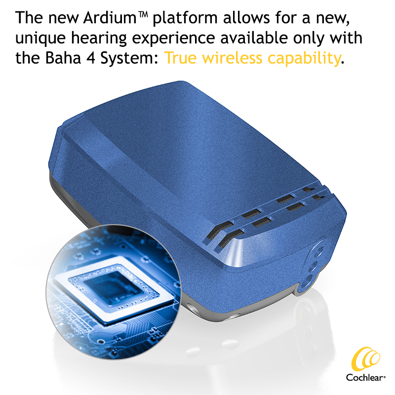 CochlearUS's tweet photo. At the center of the new #Baha4 is the Ardium™ platform, allowing true #wireless capability. http://t.co/NkAbqgFSAI http://t.co/Obss0HQ11l