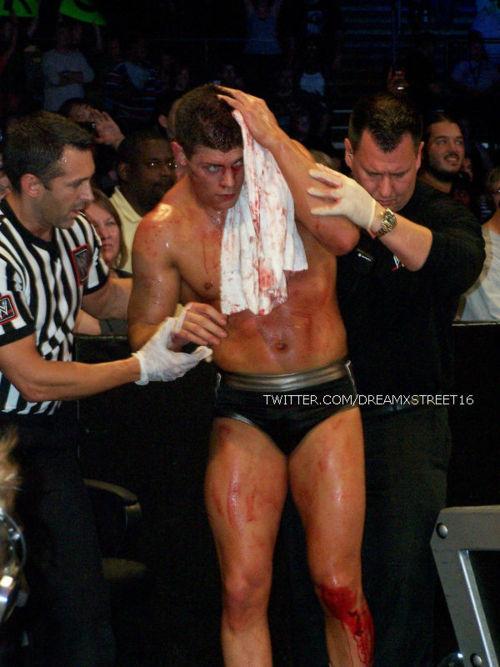 DashingGod's tweet image. I wish I could forget the pain and agony I suffered from you @SinfulOrton.