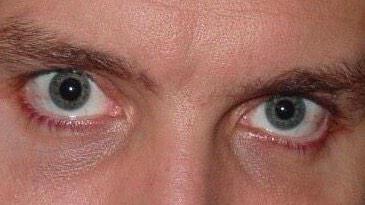 panicatthepete's tweet image. Band member eyes