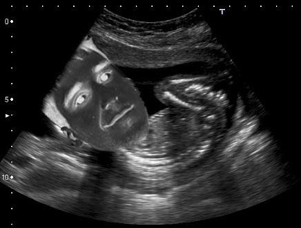 Rubiu5's tweet photo. NO PUEDO AGUANTAR MAS. Vale, si. Estoy embarazado. Y queria una niña. Pero ha salido niño y se parece a Mangel. WHYYY http://t.co/bKQOwgpkXr