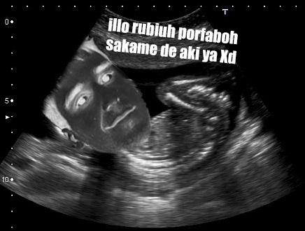 Rubiu5's tweet photo. @mangelrogel http://t.co/WgHOV5JO17
