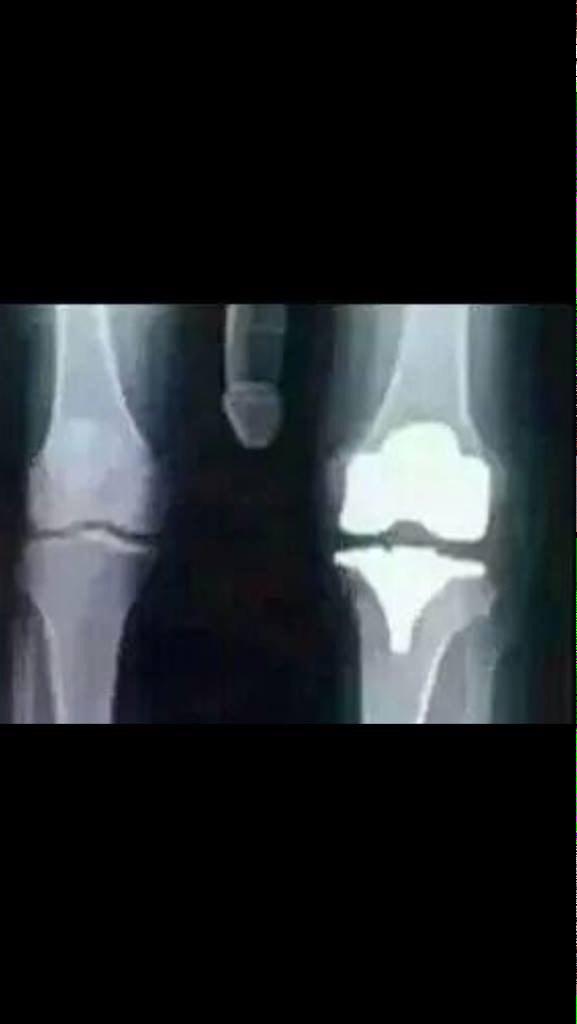 Happy Bday Todd Glass
I hurt my Knee today picking up your present 