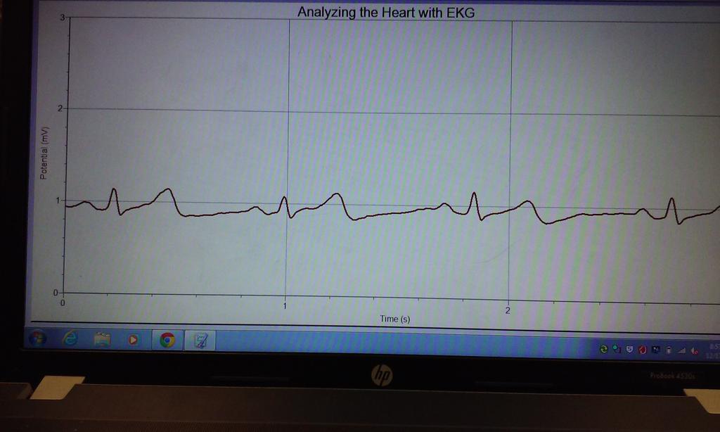 tiffiny226's tweet photo. My EKG #rhsbms http://t.co/C7eYd1RbSd