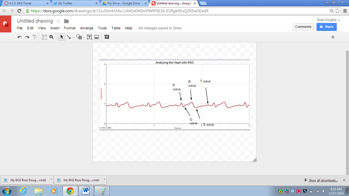 Ross_doughty's tweet photo. My EKG #RHSBMS http://t.co/qPAVvlyUxa