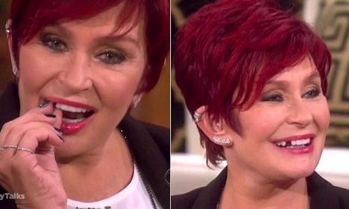 MilhoFreak's tweet image. #Ozzydeia RT @JornalOGlobo: VÍDEO: Mulher de @OzzyOsbourne perde dente ao vivo em programa de TV.