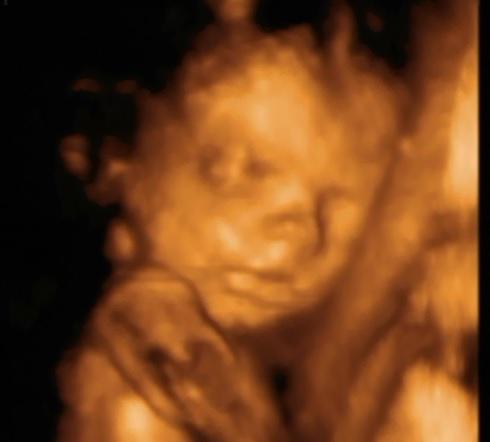 MissKathyMODEL's tweet photo. Baby Lily at 27weeks <3 http://t.co/uXIsxstsuY
