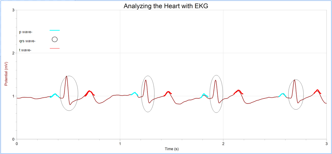 Da_Eager_Beaver's tweet photo. My EKG with labeled waves :)
#RHSBMS #PLTW @wearrrichmond http://t.co/pFzTqgCSmb