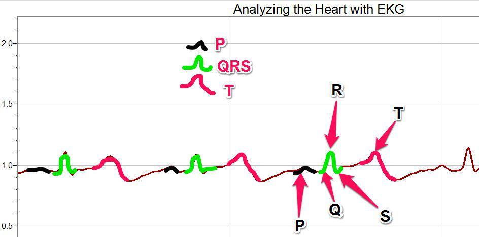 Biomed_Austin's tweet photo. My EKG Readings. #RHSBMS http://t.co/0bwaCYCszW