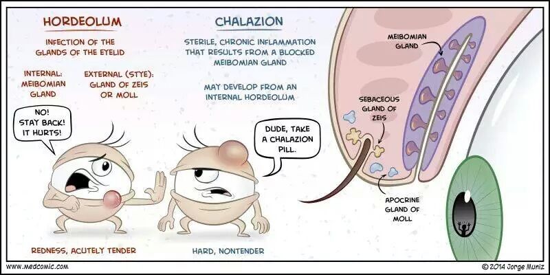 Chalazion en hordeolum - Farmacotherapeutische richtlijn