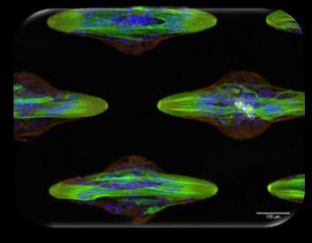 CYTOO in <a href="/GENbio/">Genetic Engineering & Biotechnology News</a>
Refining Cellular Assays via Micropatterns
Read the full story! ow.ly/G78zc