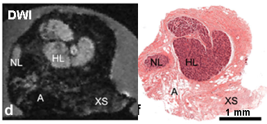 roger_bourne's tweet image. #MRI #diffusion #microimaging of #breast tissue. Lobules are distinct from stroma. onlinelibrary.wiley.com/doi/10.1002/mr…
