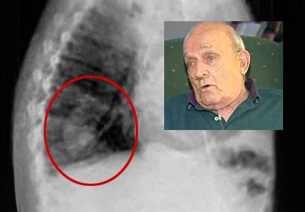 TerrorFessions's tweet photo. The 10 strangest things ever to be found in human x-rays, #2 resulted in the death penalty: http://t.co/ydWl7VW3MB http://t.co/qwABB20qJz