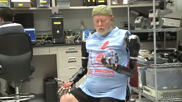 MoeGoswami's tweet photo. Wow, this is truly amazing! Double amputee controls robotic arms with his mind.  http://t.co/iz6fPRjyq4  #tech http://t.co/Z5H0G5lNtw