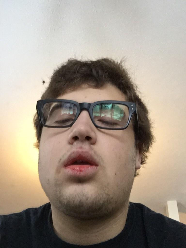 justhitvtec's tweet photo. Post wisdom teeth removal surgery. #highhhhh http://t.co/X7vDboCNnt