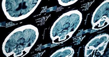 ClevelandClinic's tweet photo. FACT: 80% of #strokes can be prevented http://t.co/CUau0W5HLD